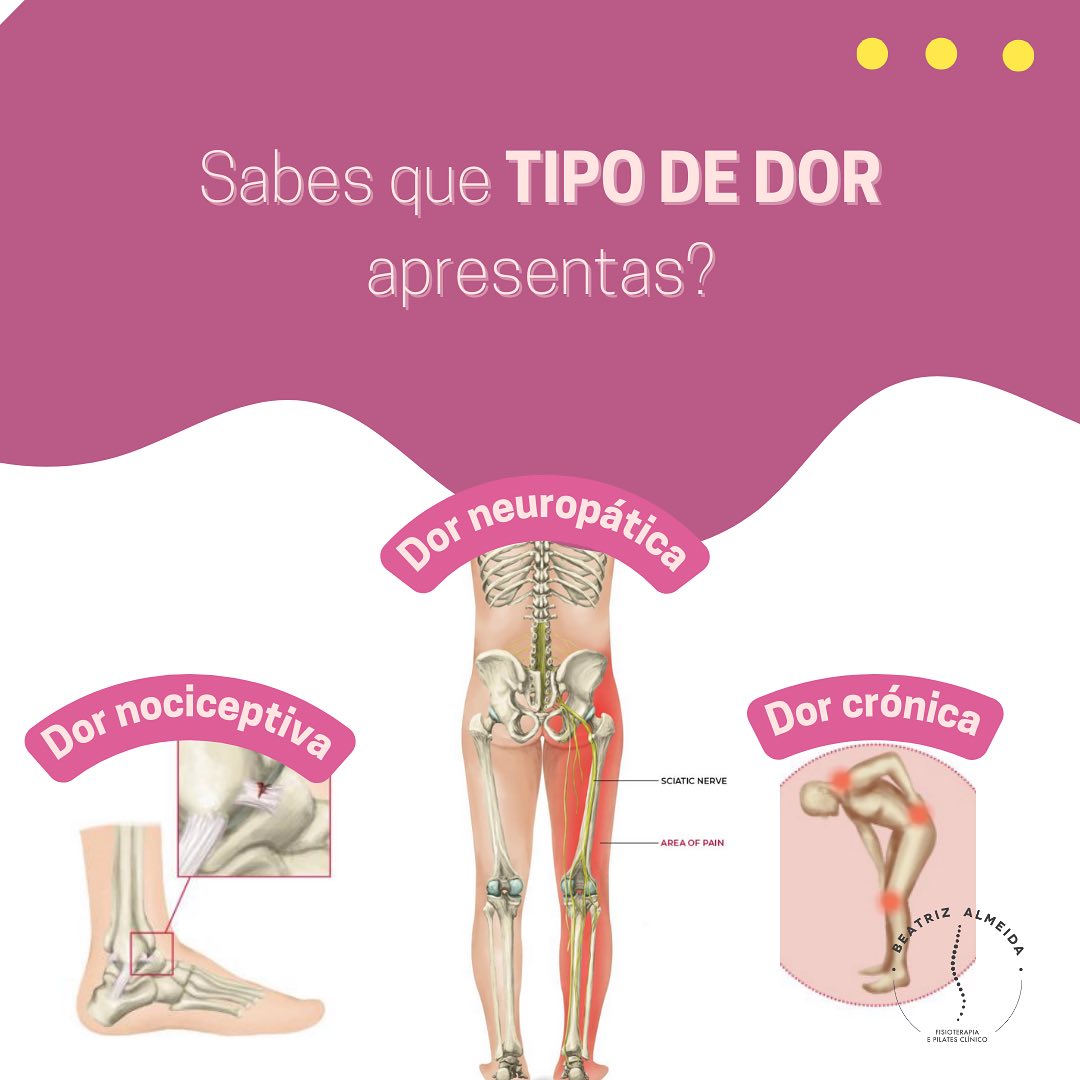 Sabes identificar o tipo de dor que apresentas?